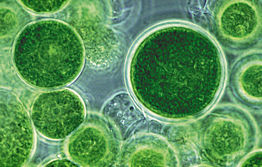 Clorella: i grandi benefici di una piccola alga.